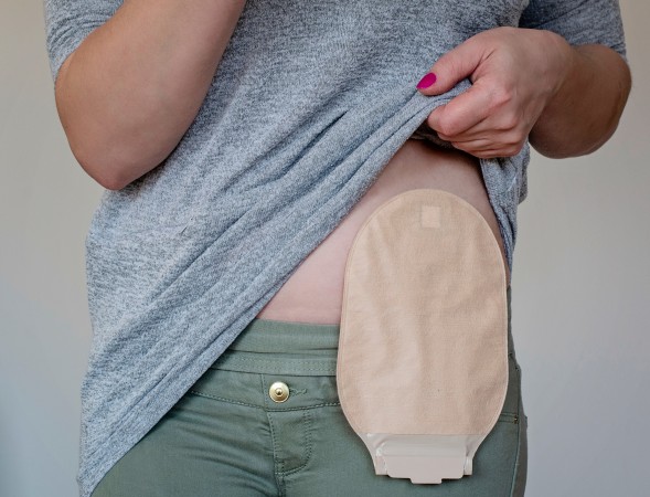 Ostomy Bags