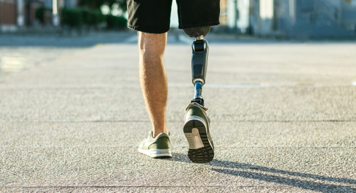 Prosthesis & Patient Assistance